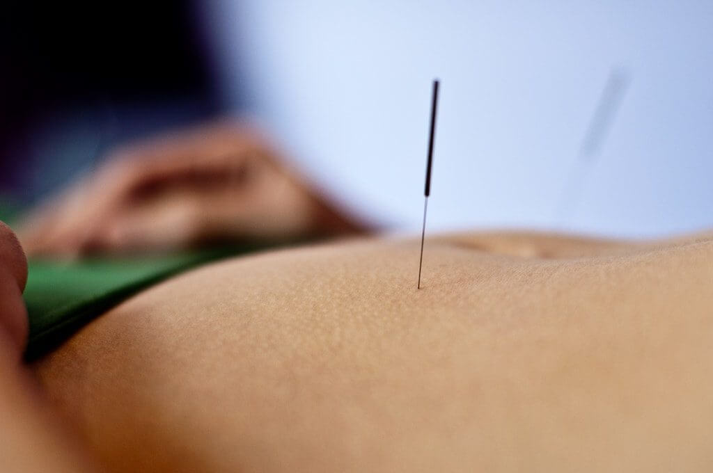 agopuntura e fertilità pancia