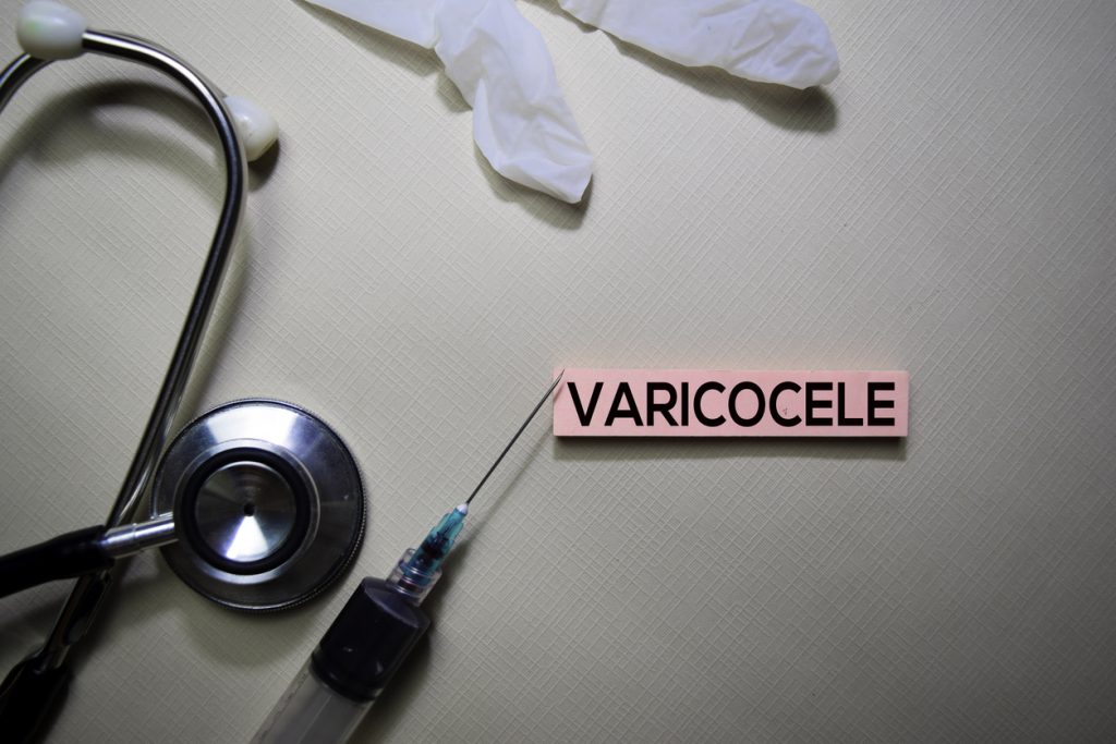 varicocele e infertilità diagnosi e cure