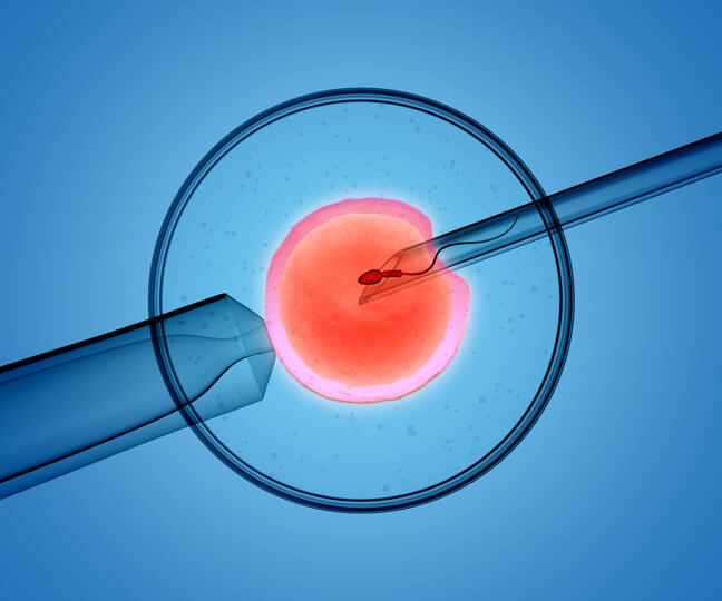 icsi su ciclo spontaneo