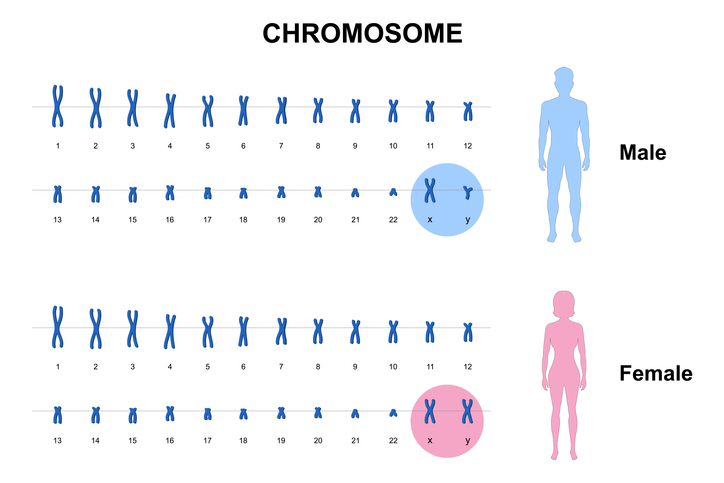 Sindrome dell' X fragile, diagnosi e sintomatologia