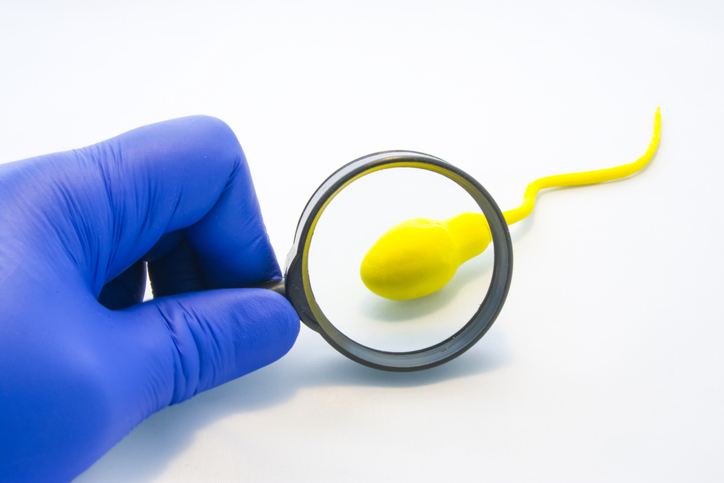 Spermatozoi lenti, causa di infertilità e rimedi