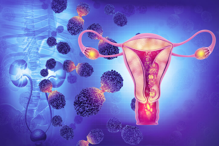 Tumori all'utero e gravidanza, quali conseguenze?