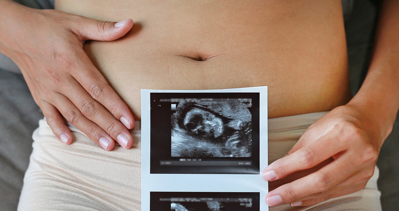 Translucenza nucale maschio o femmina