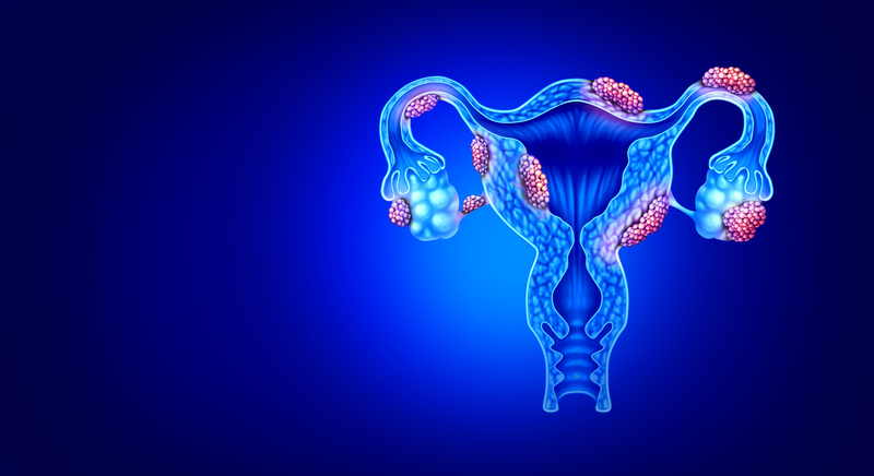 Endometriosi e fecondazione assistita: è possibile?