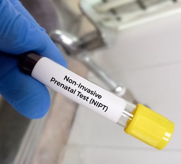 test prenatali non invasivi quali sono