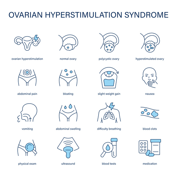 Sindrome da iperstimolazione ovarica: cos’è e quali sono i sintomi